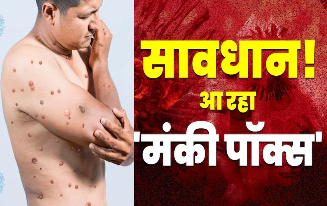 Mpox Virus: पाकिस्तान में भी फैला Mpox का कहर, सऊदी अरब से लौटे शख्स में मिला वायरस का लक्षण, जानिए वायरस से अबतक कितने लोगों की हुई मौत 