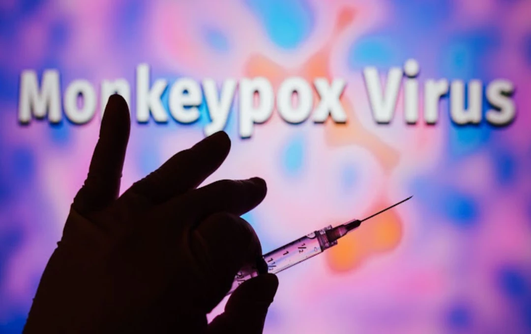 Mpox Virus: Mpox वायरस से रहें सावधान, अगर जाना चाहते है विदेश, तो रखें इन बातों का ध्यान 