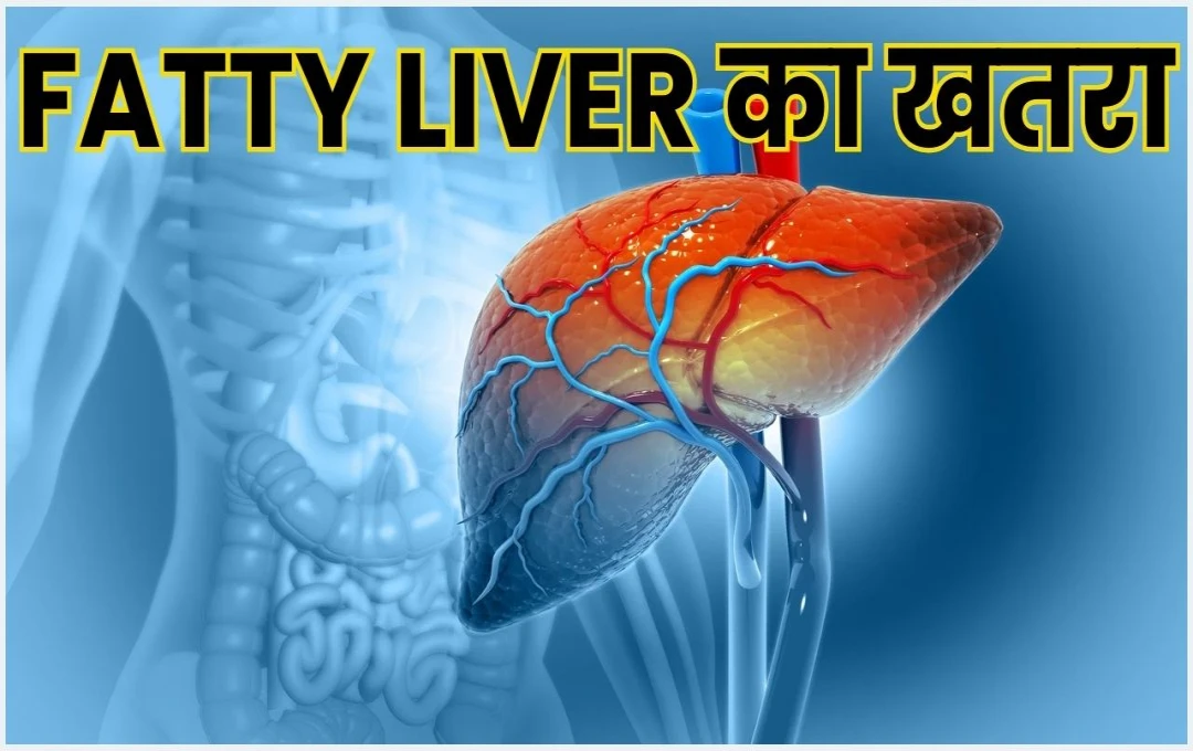 कम उम्र में Fatty Liver का खतरा: समय रहते जागरूक होकर गंभीर स्वास्थ्य समस्याओं से बचें