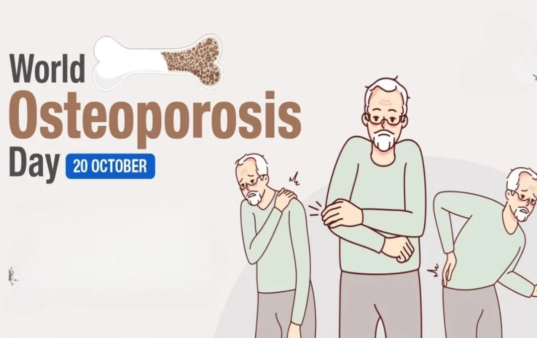 World Osteoporosis Day 2024: ऑस्टियोपोरोसिस दिवस का महत्व, इतिहास और इस वर्ष की थीम