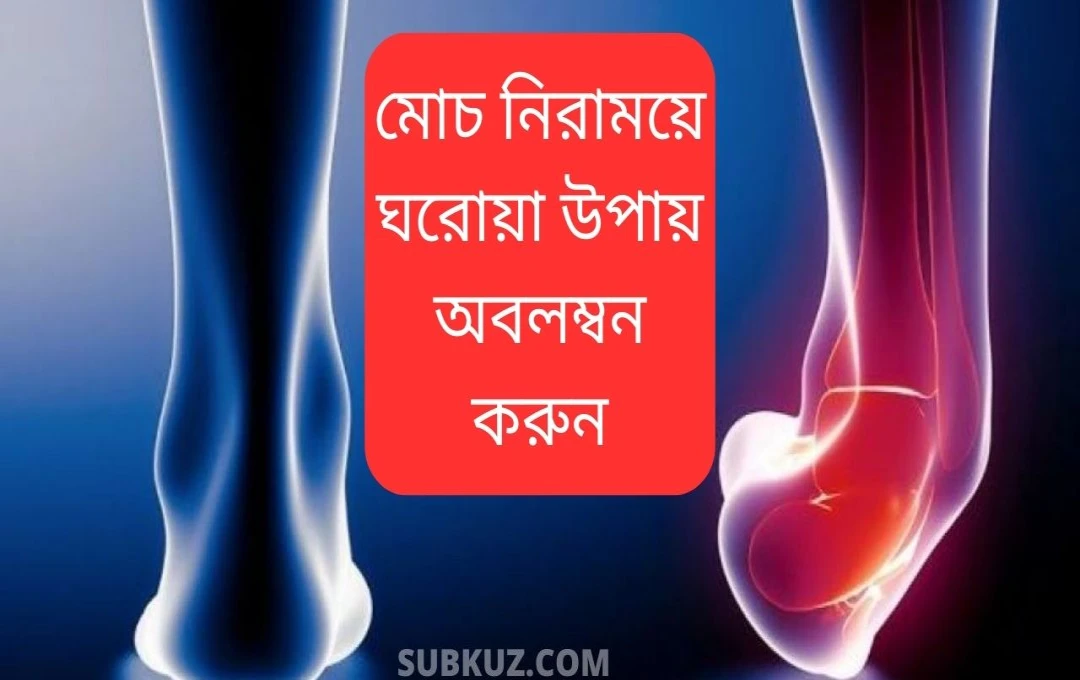বাড়িতেই মচকের সমস্যার সমাধান: ঘরোয়া উপায়