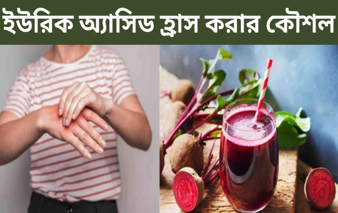 চুকন্দরের রস দিয়ে ইউরিক এসিড কমানোর সহজ উপায়