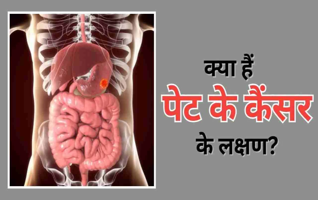 स्टमक कैंसर के लक्षण अक्सर देर से दिखते हैं: समय पर Screening से कैसे बच सकती है जान