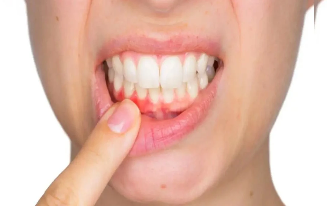 Bleeding Gums: A Warning Sign of Serious Health Issues