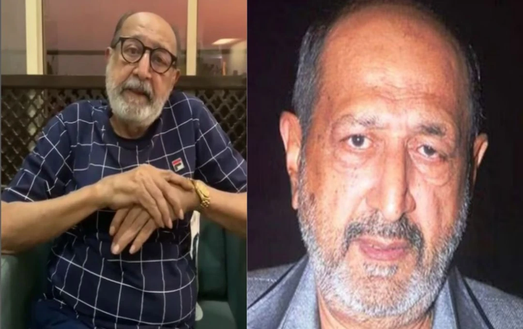 आवारा कुत्तों पर बयान देकर ट्रोल हुए टिन्नू आनंद, बोले– 'हमले में बेटी की कलाई टूट गई थी'
