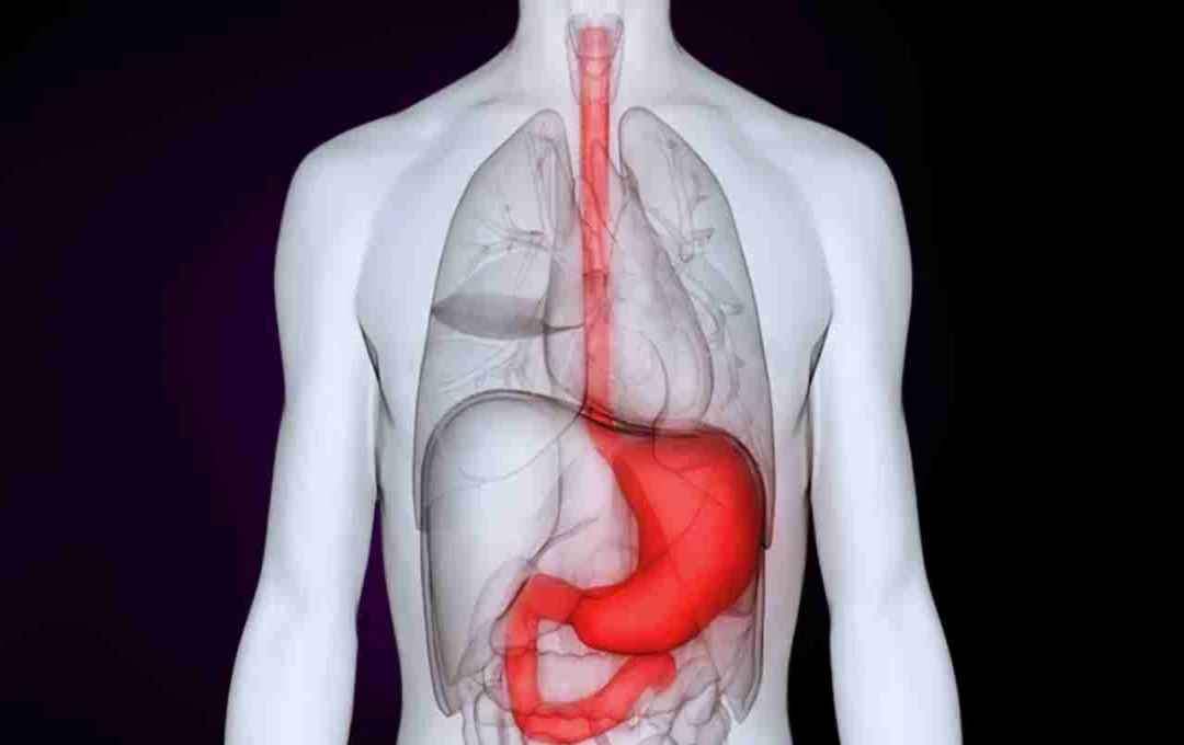 Understanding and Preventing Stomach Cancer