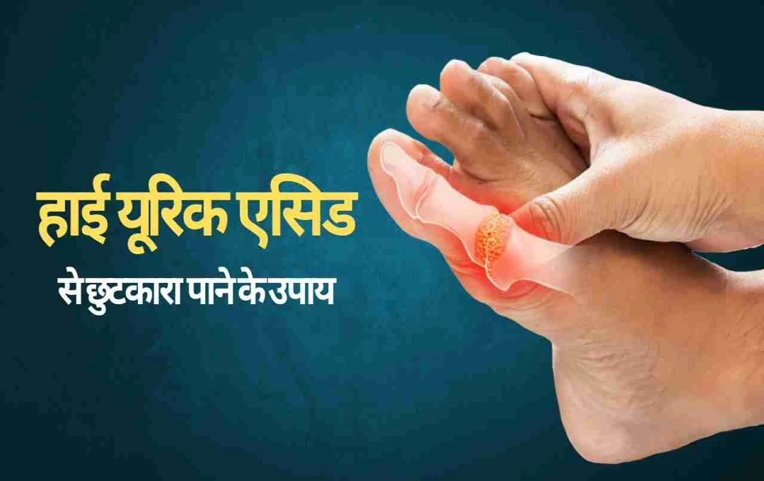 हाई यूरिक एसिड से छुटकारा, प्राकृतिक उपायों से पाएं राहत, अपनाएं ये 7 हेल्थ टिप्स  