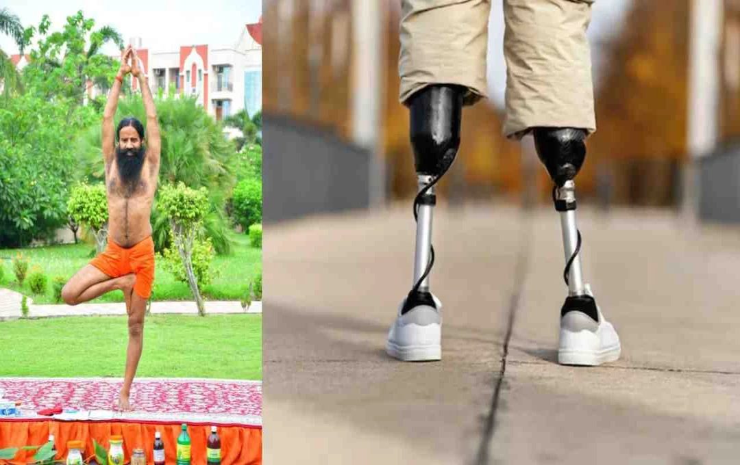 Patanjali Yogpeeth Empowers Persons with Disabilities Through Free Artificial Limb Camp