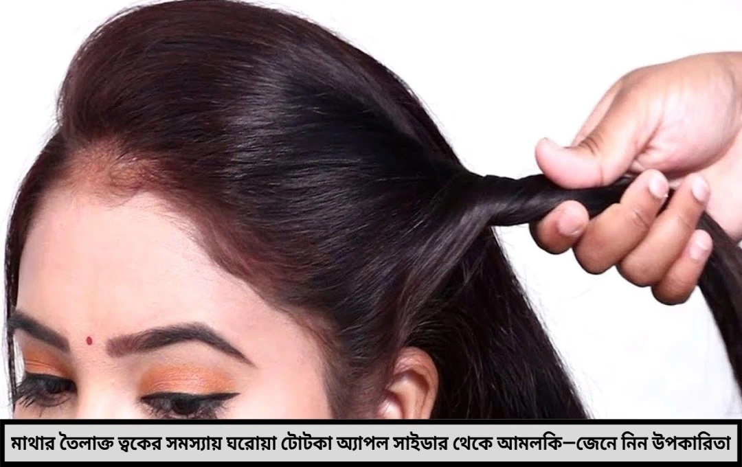 মাথার তৈলাক্ত ত্বকে ত্রাহি অবস্থা ঘরোয়া টোটকায় মিলবে মুক্তি!