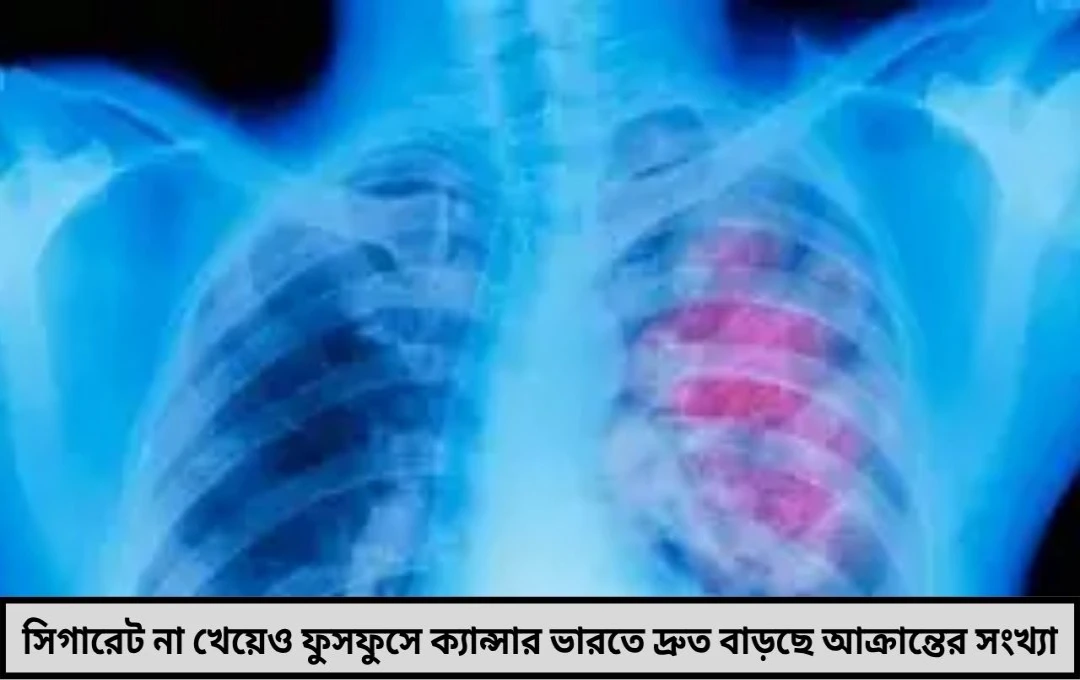 ধূমপান নয় তবুও ফুসফুসে ক্যান্সার আশঙ্কা বাড়ছে ধূমপায়ী নন এমন মানুষদের মধ্যেও