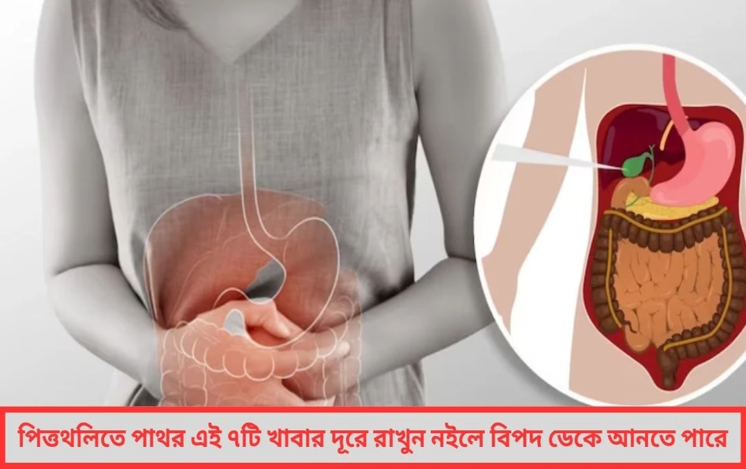 গলব্লাডারে স্টোন ভুল খাদ্যাভ্যাসেই বাড়ছে বিপদ!