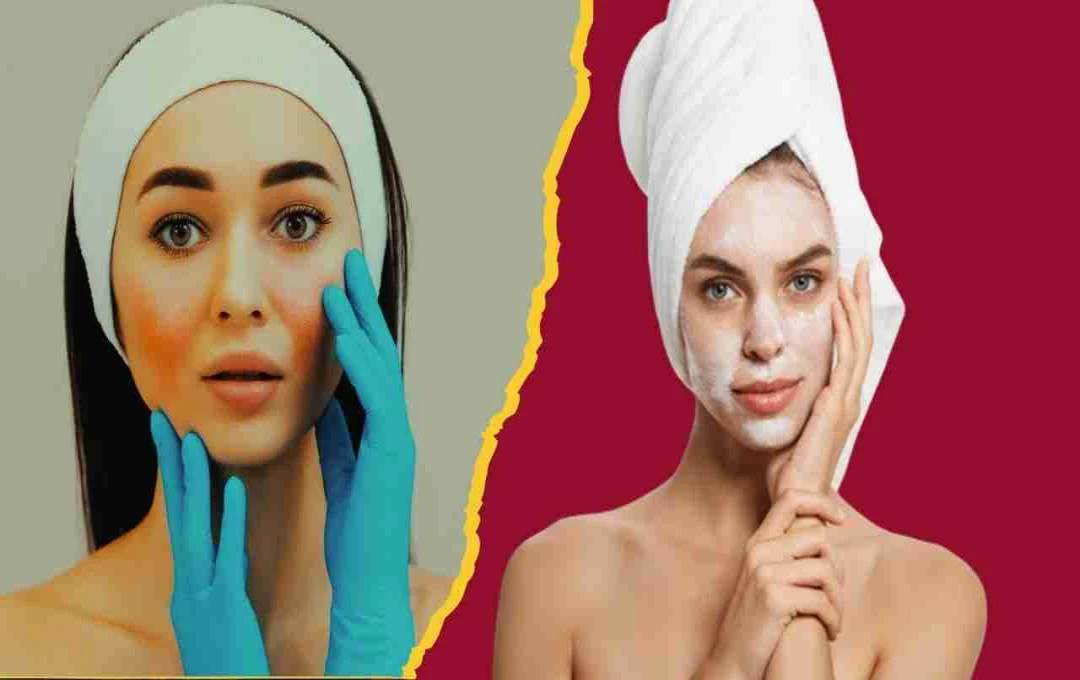 चेहरे पर ब्लीच के बाद जलन से छुटकारा पाने के लिए अपनाएं ये 2 घरेलू उपाय – जानिए संदीप शर्मा  के ब्यूटी टिप्स