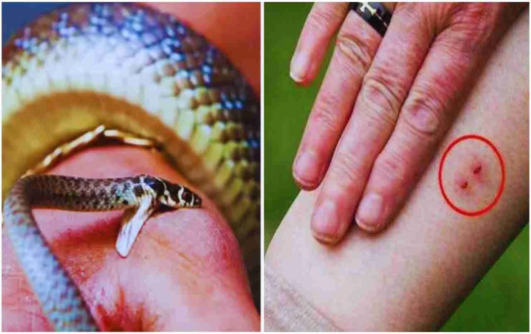 सांप काटने पर करें ये जरूरी उपाय: जानिए कैसे बचाएं ज़िंदगी
