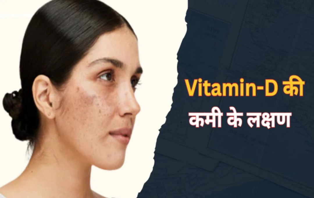 5 Skin Problems That Could Indicate a Vitamin D Deficiency