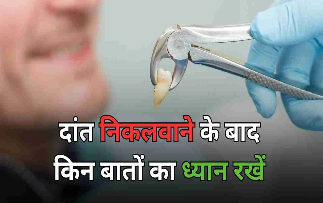 Tooth Extraction Aftercare: दांत निकलवाने के बाद किन बातों का ध्यान रखें, डेंटिस्ट से जानें