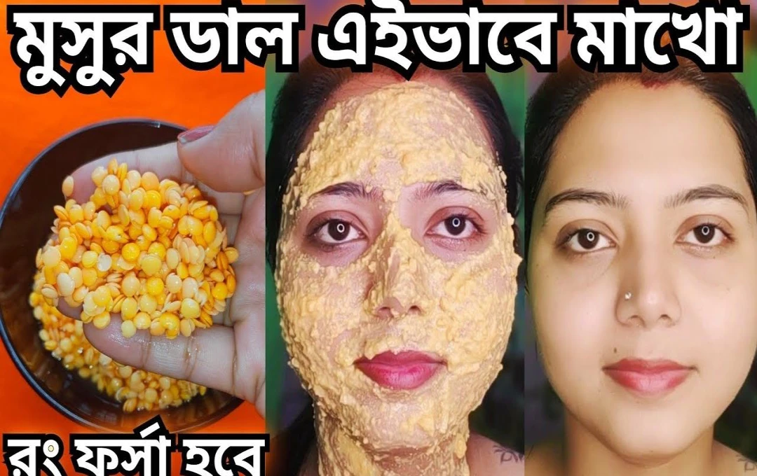 মুখের অতিরিক্ত তেল নিয়ন্ত্রণে রাখবে মুসুর ডাল ঘরোয়া প্যাকের মাধ্যমে পান ত্বকের জেল্লা ও সতেজতা