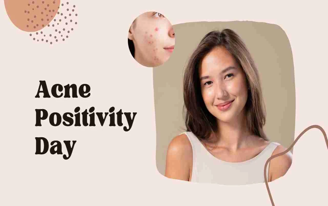 Acne Positivity Day: त्वचा से प्यार और आत्मविश्वास का उत्सव