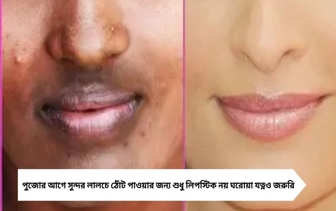 পুজোর আগে ঠোঁটের কালচে ছোপ দূর হবে এই ৫ ঘরোয়া টোটকা
