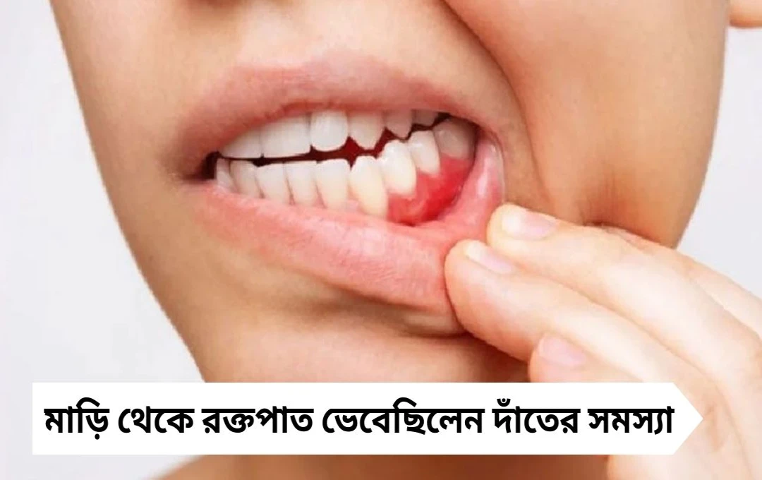 মাড়ি থেকে রক্ত, দাঁতের সমস্যা ভেবেছিলেন তরুণী! পরীক্ষায় ধরা পড়ল বিরল রক্তের ক্যান্সার – ক্রনিক 