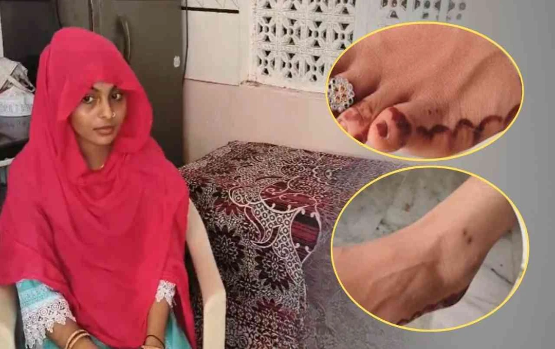 Woman Bitten by Snake Eight Times in Six Months, Doctors Baffled