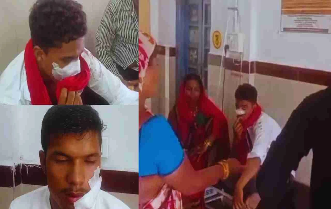 MP: आदिवासी इलाके में लड़की छेड़ने को लेकर झगड़ा, तीर-कमान से 2 युवक घायल