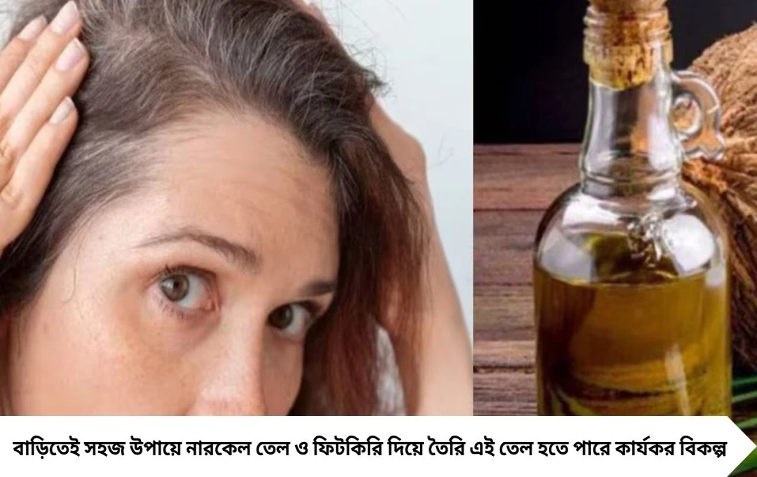 White Hair Stopping Tips: চুল পাকা ও খুশকির অবসান নারকেল তেল-ফিটকিরি মিশ্রণে

