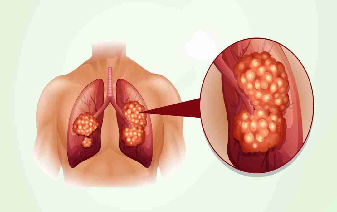 Early Warning Signs of Lung Cancer: What to Look Out For