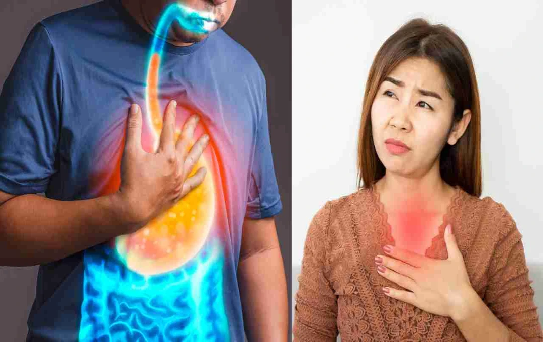 मसालेदार खाना ही नहीं, ये 5 कारण भी बढ़ाते हैं एसिड रिफ्लक्स, जानें लक्षण और बचाव
