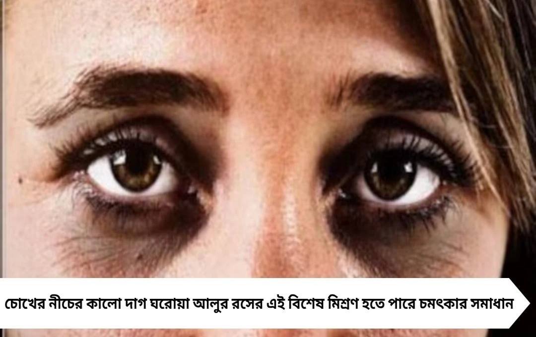 Undereye Dark Circles Home Remedies: দামি ক্রিম নয়! আলুর রসে ‘এই মিশ্রণ’ লাগালেই মিলবে উজ্জ্বল চোখের ত্বক