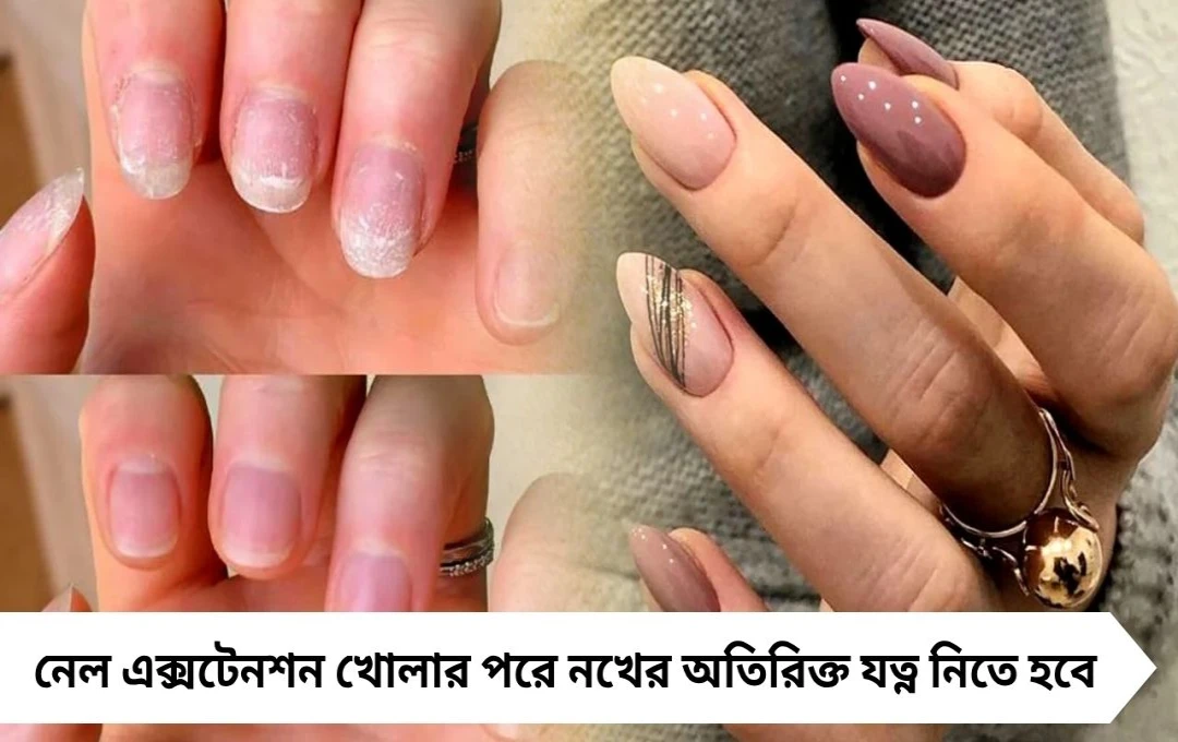 নেল এক্সটেনশন খোলার পরে নখের যত্ন: কী করবেন ও কী এড়াবেন