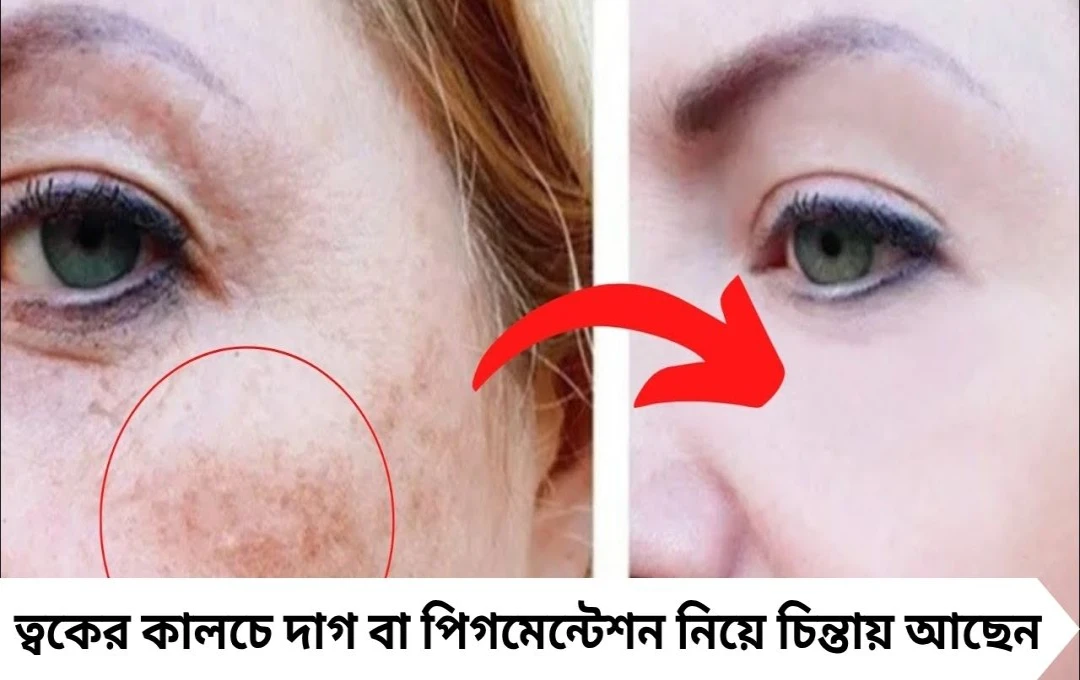  কালচে ছোপে ঢেকে গিয়েছে জেল্লা? প্রসাধনী ছেড়ে বেছে নিন ঘরোয়া সমাধান