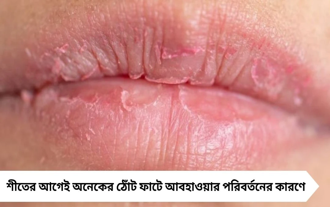 Lip Care Tips: শীতের আগেই ঠোঁট ফাটছে? ঘরোয়া উপায়ে ফিরে পান নরম তুলতুলে ঠোঁট