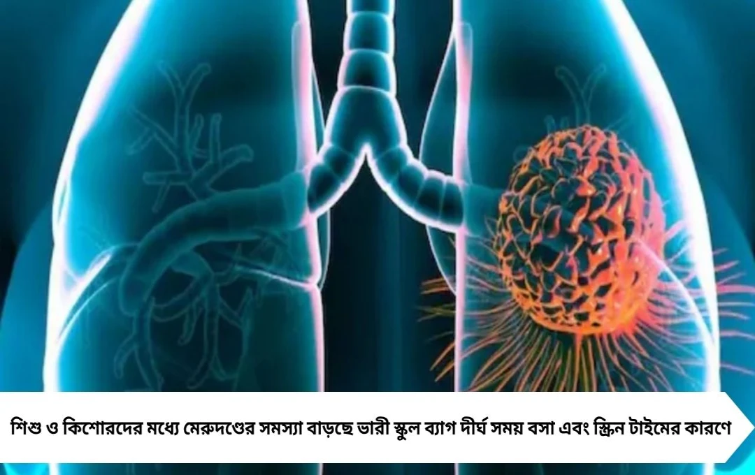 World Spine Day: শিশু ও কিশোরদের মেরুদণ্ডের সমস্যা বাড়ছে