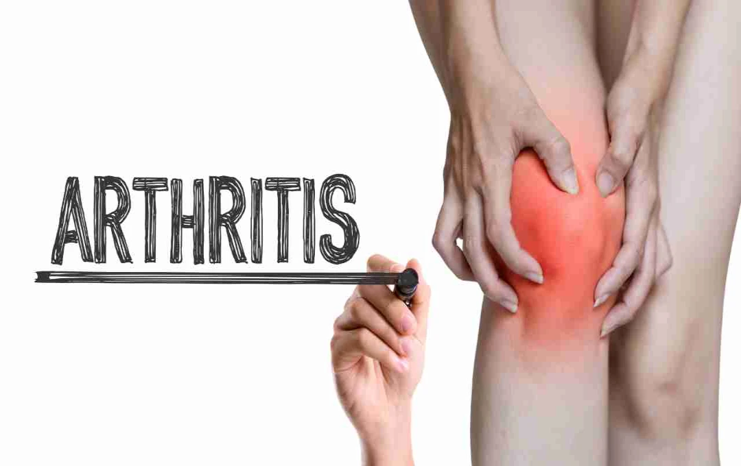 Arthritis: जोड़ों में सूजन और अकड़न को न करें नजरअंदाज, ऐसे पहचानें आर्थराइटिस के शुरुआती लक्षण