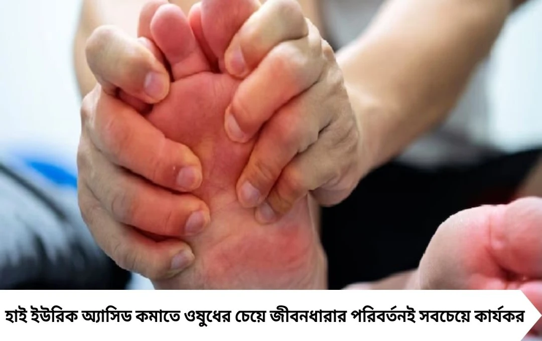 হাই ইউরিক অ্যাসিড কমানোর ঘরোয়া উপায়, বিশেষজ্ঞরা বলছেন ৭টি সহজ কৌশল