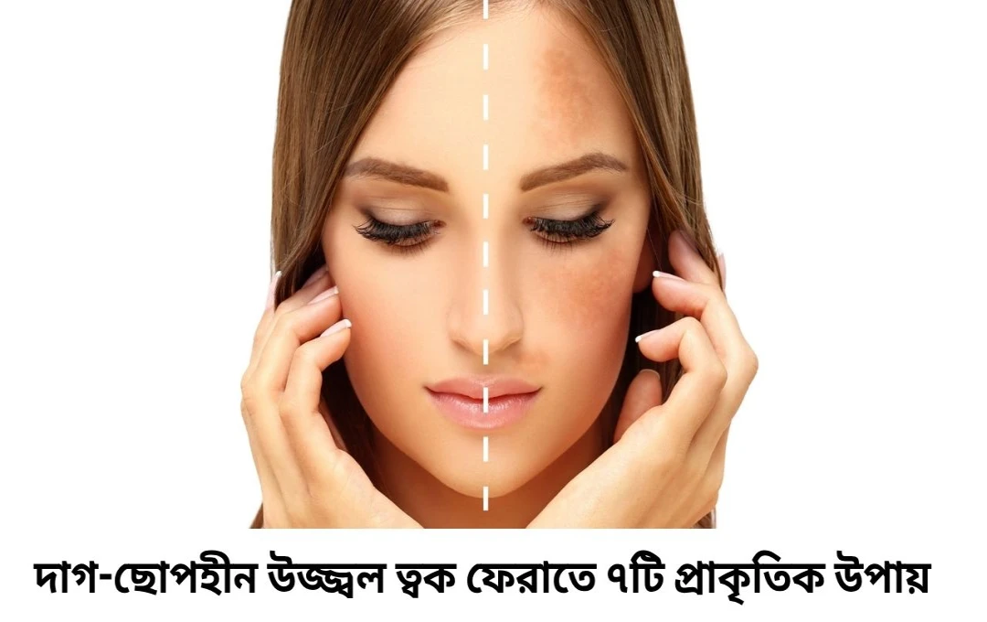 পিগমেন্টেশন দূর করার ঘরোয়া টিপস: দাগ-ছোপহীন উজ্জ্বল ত্বক ফেরাতে ৭টি প্রাকৃতিক উপায়