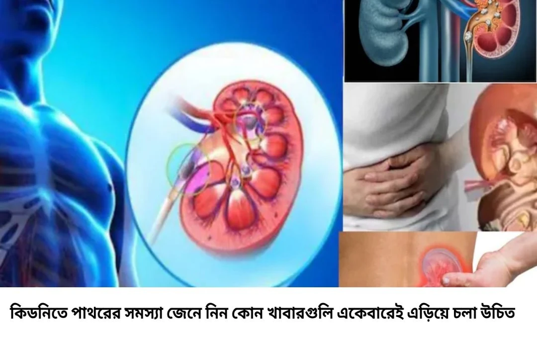 পাথর জমে অকেজো হবে কিডনি! ভুলেও খাবেন না এই ‘সবুজ শাক’ ও ‘লাল সবজি’