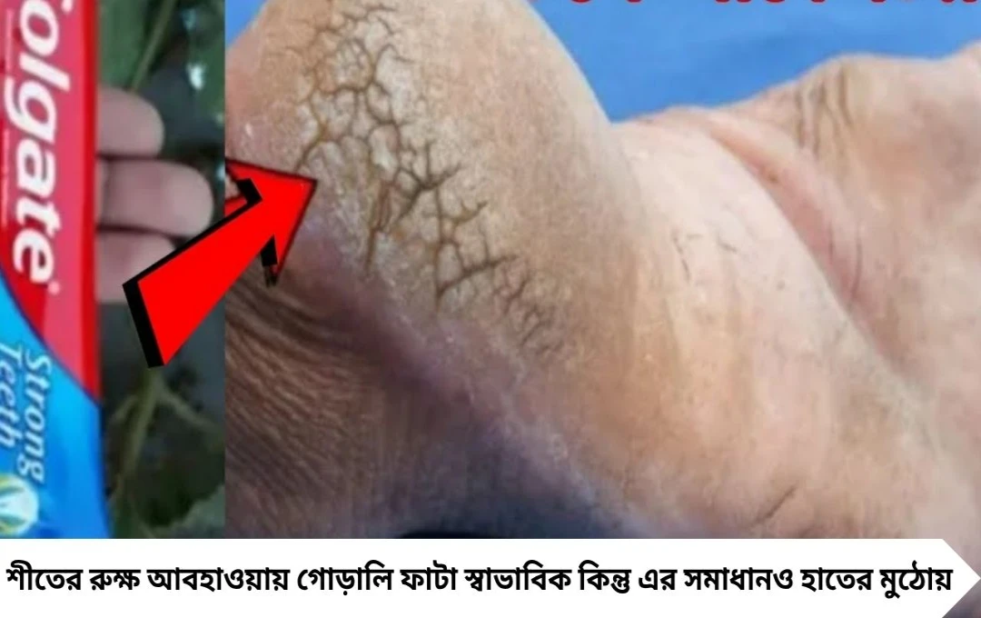 Cracked Heel Remedies: দামী ক্রিম নয়, টুথপেস্টেই ফাটা গোড়ালি মসৃণ! ঘরে বসেই পাবেন নরম তুলতুলে পা