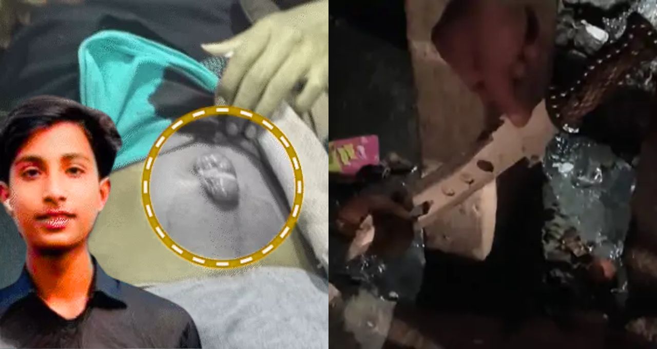 बरेली में बाइक गाली पर विवाद हुआ खूनी, समीर हाफिजगंज पर चाकू से किया हमला