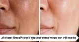 Face Care Tips: রাতে ঘুমের আগে এই ঘরোয়া ম্যাসাজ, ৫ দিনেই ফুটফুটে ত্বক! আয়নাও দেখবে নতুন আপনি
