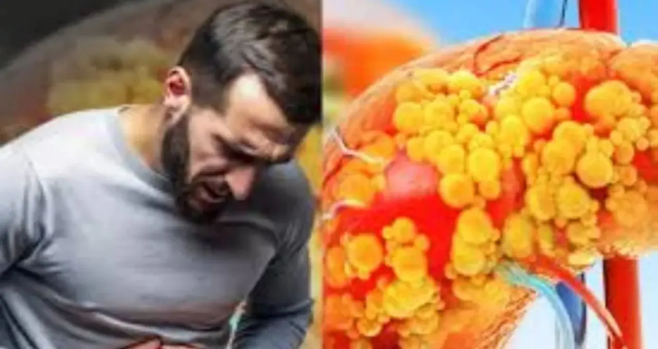 Fatty Liver Alert: তেল-ঘি নয়, এই ২ খাবারেই লিভারে জমছে ‘বদ’ চর্বি! বিশেষজ্ঞের সতর্কবার্তা
