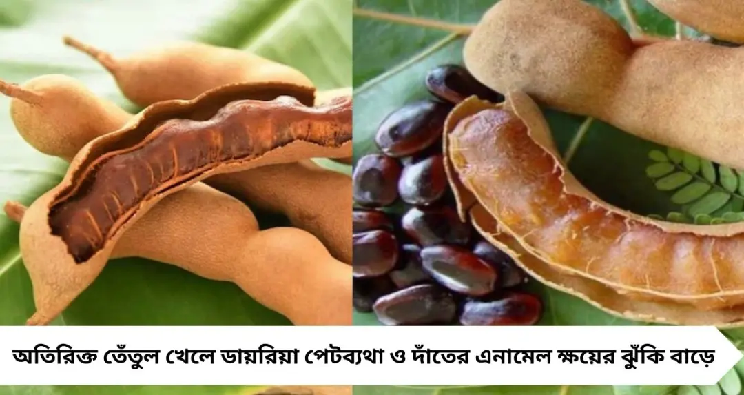 Tamarind Side Effects: বেশি তেঁতুলেই বিপদ! দাঁতের ক্ষয় থেকে ডায়রিয়া—কারা একেবারেই এড়িয়ে চলবেন এই টক ফল?
