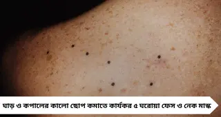 ঘাড়ে-কপালে কালো ছোপ? পার্লার ছাড়াই ৫ ঘরোয়া মাস্কে ফিরতে পারে উজ্জ্বলতা
