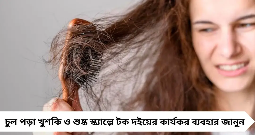 চুল পড়া, খুশকি, ড্রাই স্ক্যাল্পে দারুণ কাজ করে টক দই! ঘরোয়া উপায়েই ফিরুক চুলের জেল্লা