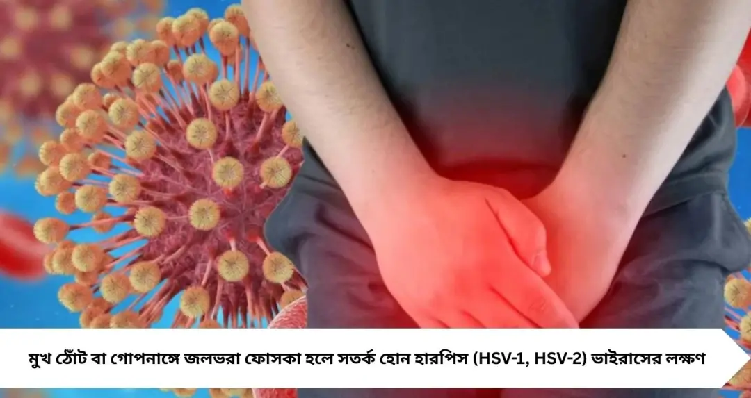 Herpes Symptoms: মুখ-ঠোঁট বা গোপনাঙ্গে জলভরা ফোসকা? অবহেলা নয়—হারপিসের লক্ষণ ও প্রতিরোধ জানুন এখনই
