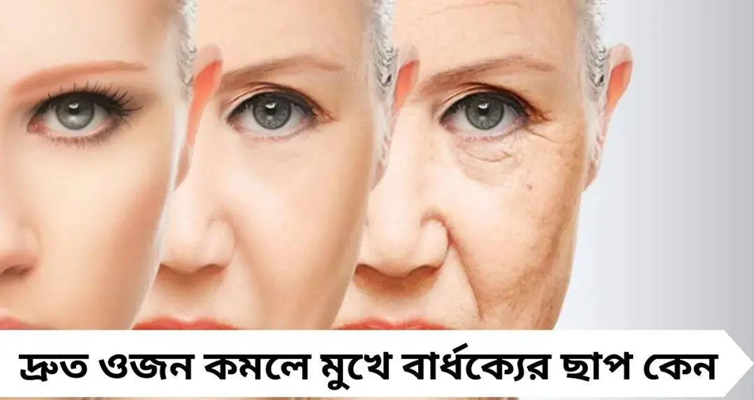 Ozempic Face: হুড়মুড়িয়ে ওজন কমলে মুখে বার্ধক্যের ছাপ? টাইপ ২ ডায়াবেটিসে ওজেম্পিক নেওয়ার আগে জানুন
