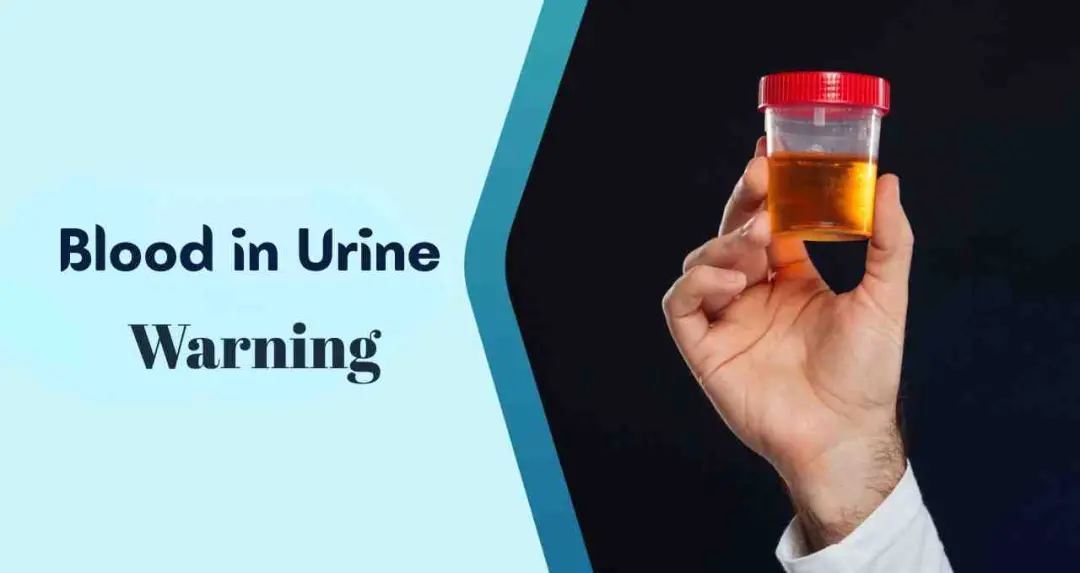 यूरिन में खून और किडनी कैंसर का कनेक्शन, डॉक्टर ने दी जरूरी सलाह
