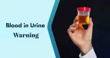 यूरिन में खून और किडनी कैंसर का कनेक्शन, डॉक्टर ने दी जरूरी सलाह