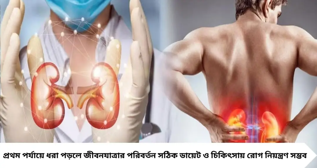 ফার্স্ট স্টেজেই কিডনির সতর্কবার্তা! শরীরের এই ৪ সিগন্যাল দেখলেই সতর্ক হন, নইলে বাড়বে ঝুঁকি

