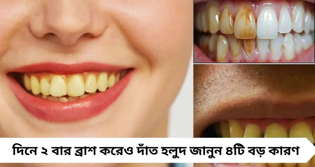 Yellow Teeth: দিনে ২ বার ব্রাশ করেও দাঁতে হলুদ দাগ? নেপথ্যে এই ৪ কারণ, জানুন কী বলছেন বিশেষজ্ঞ
